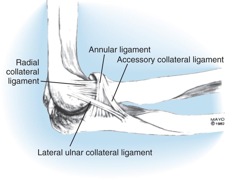 FIG 2.24, Schematic representation of the radial collateral ligament complex showing several portions, one of which, termed the radial collateral ligament , extends from the humerus to the annular ligament. This is the portion that is implicated in clinical instability. 27