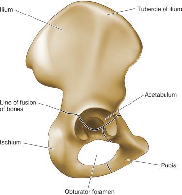 Fig. 12.3, The hemipelvis comprises the ilium, the ischium, and the pubis.