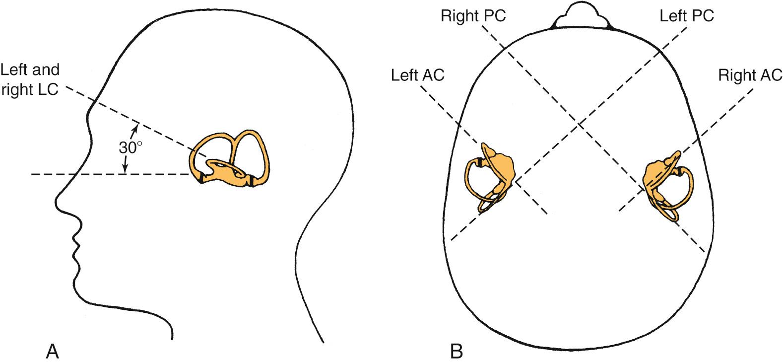 Fig. 129.2, Orientation of the semicircular canals.