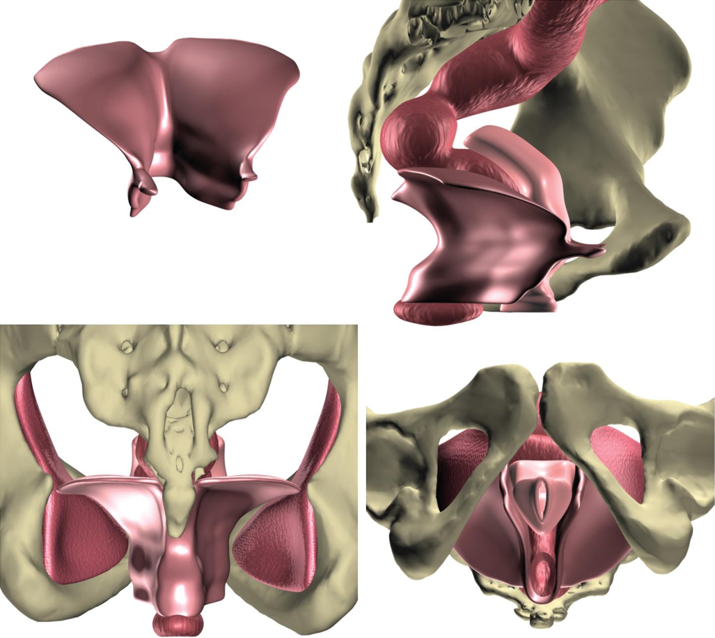 Fig. 1.3, Digitally enhanced three-dimensional reconstructions of the female pelvic floor from a magnetic resonance image of the pelvis in a healthy, nulliparous 23-year-old woman. Upper left: anterior view of the levator ani muscle with normal resting tone. Upper right: sagittal view of the levator ani muscle, bony pelvis, vagina, and rectum. Lower left: posterior view of the levator ani muscle, obturator internus muscles, and bony pelvis. Lower right: lithotomy view.
