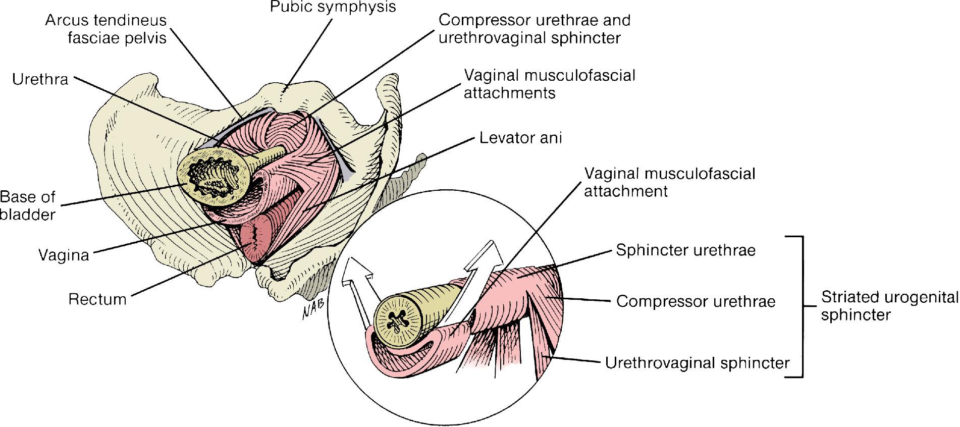 Fig. 1.7, Diagrammatic representation showing the component parts of the urethral support and sphincteric mechanisms. Note that the proximal urethra and bladder neck are supported by the anterior vaginal wall and its musculofascial attachments to the pelvic diaphragm. Inset , Contraction of the levator ani muscles elevates the anterior vagina and overlying bladder neck and proximal urethra, contributing to bladder neck closure. The sphincter urethrae, urethrovaginal sphincter, and compressor urethrae are all parts of the striated urogenital sphincter.