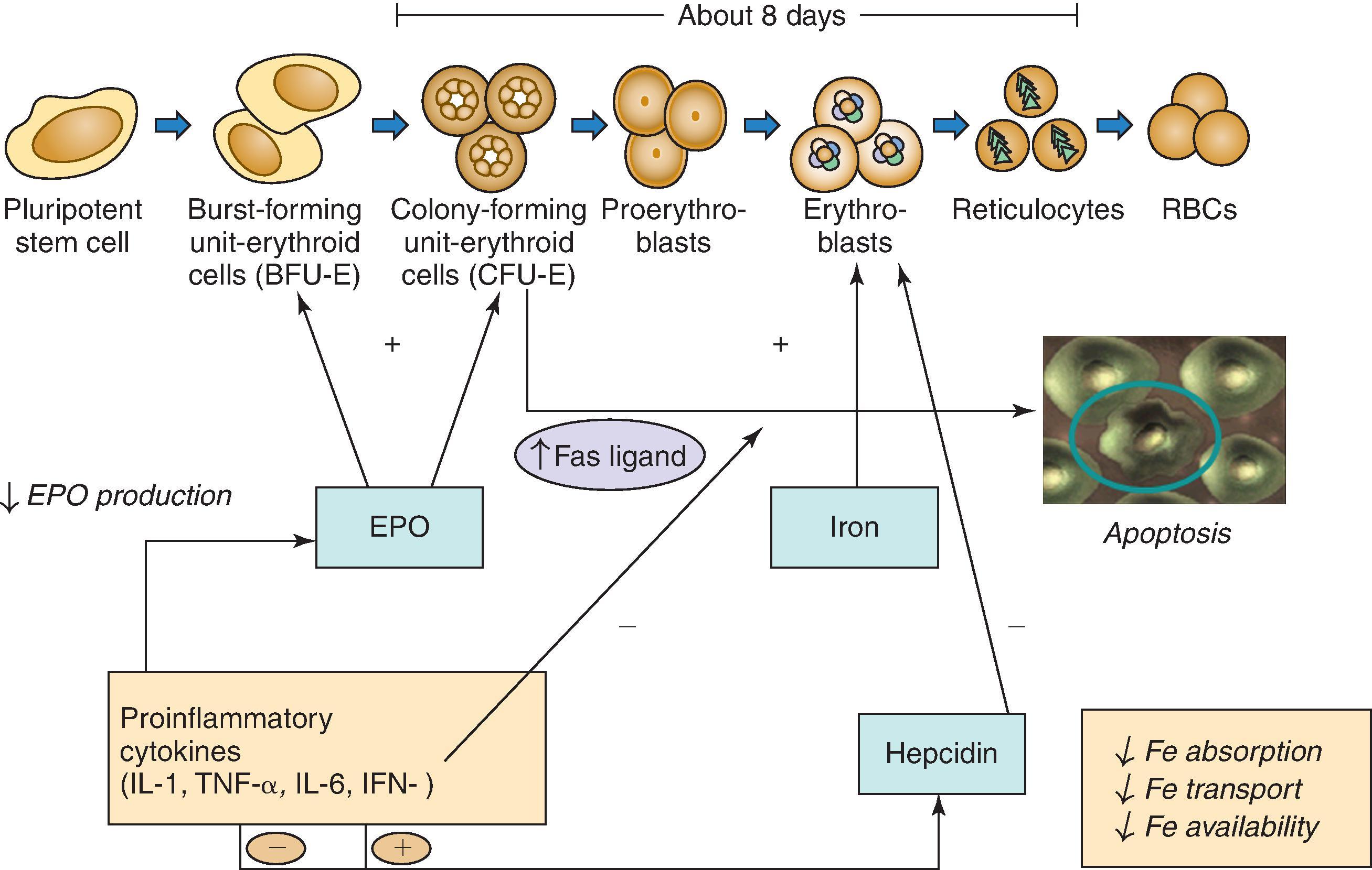 Fig. 55.1, Erythropoiesis in chronic kidney disease. EPO , Erythropoietin; Fe , iron; IFN , interferon; IL , interleukin; RBCs , red blood cells; TNF , tumor necrosis factor. (Courtesy Iain Macdougall, MD.)