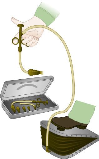 Fig. 6.1, Fell-O’Dwyer apparatus.
