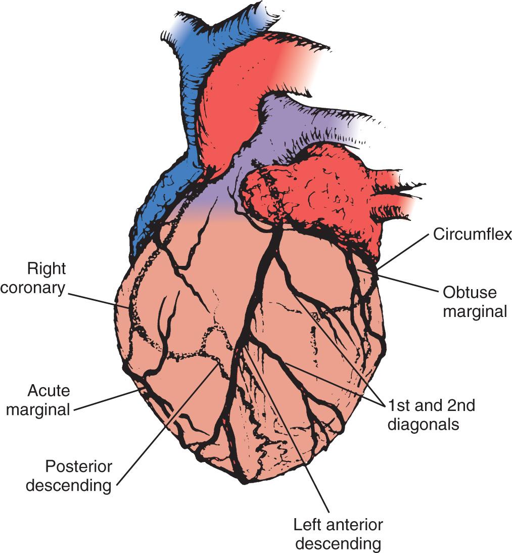 Fig. 14.2, Thirty-degree left anterior oblique angiographic view of the heart, which best shows the right coronary artery. Lines indicate common sites of distal vein graft anastomoses.