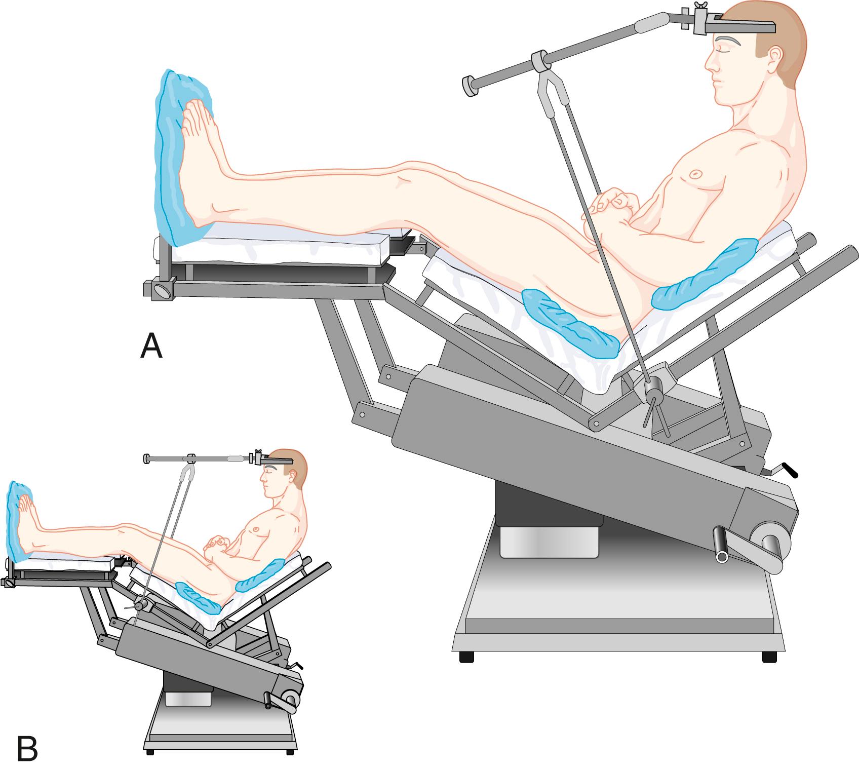 Fig. 57.8, The sitting position.