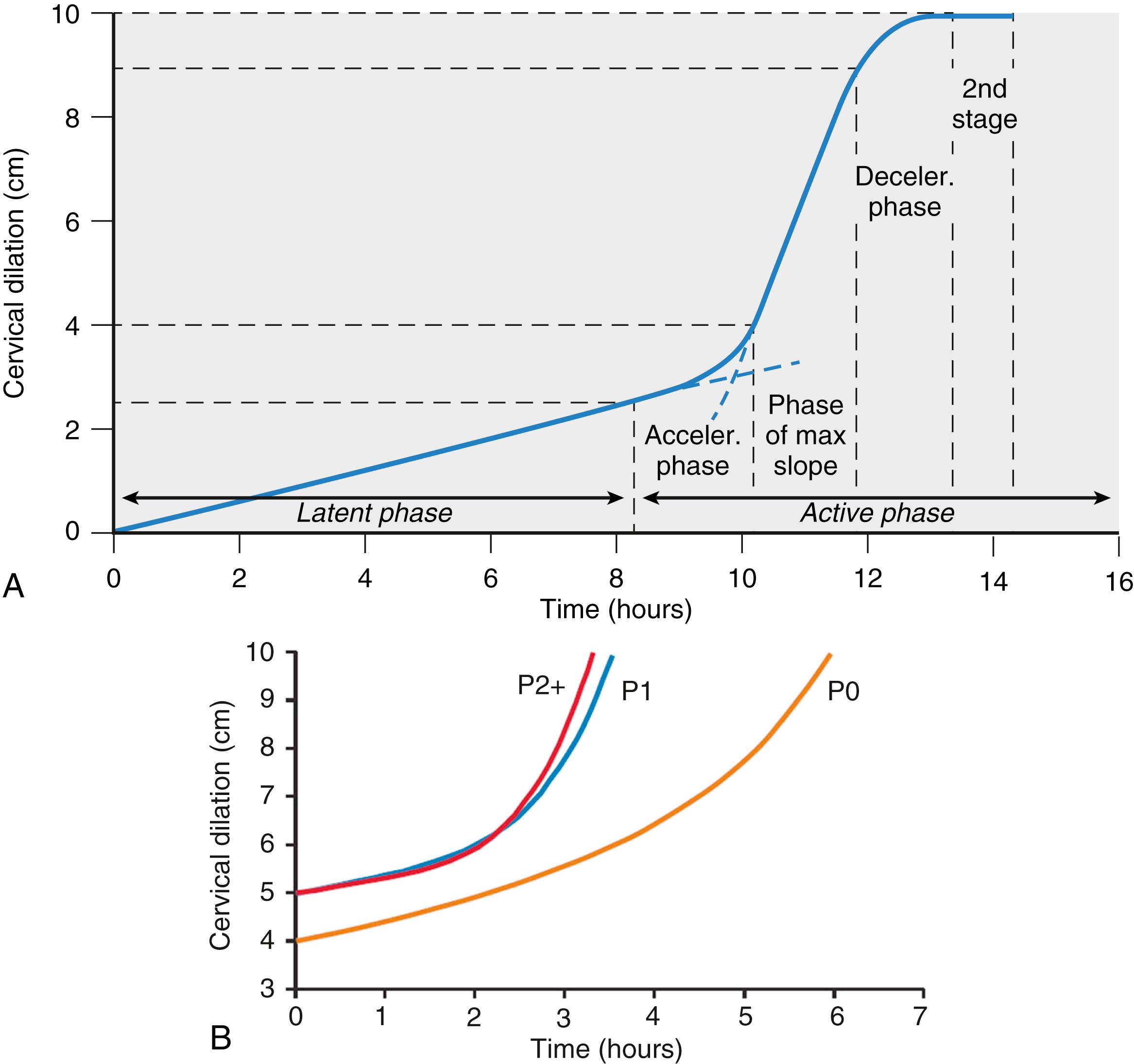 Fig. 62.2, Cervical dilation.