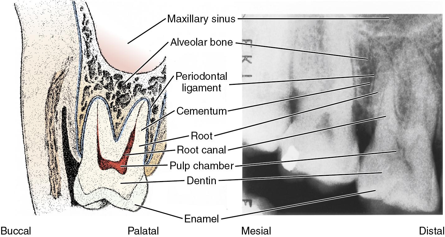 Fig. 42.2, Schematic (Left) and Radiographic (Right ) Views of a Right Maxillary Molar.