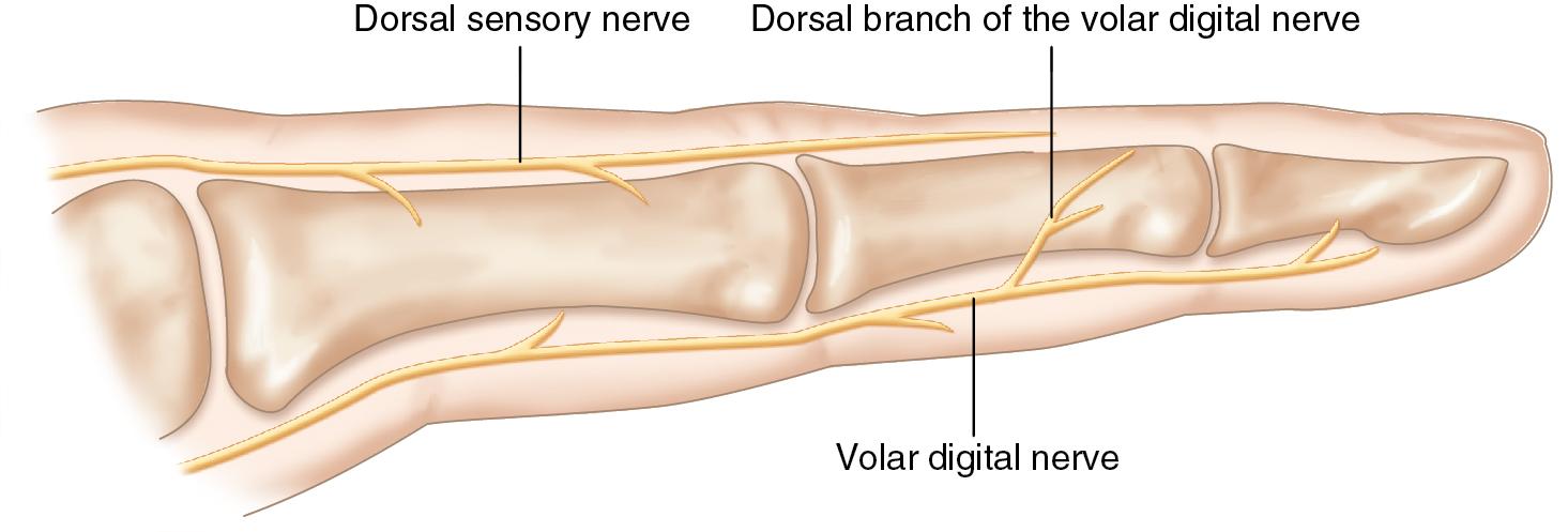 FIGURE 1.6