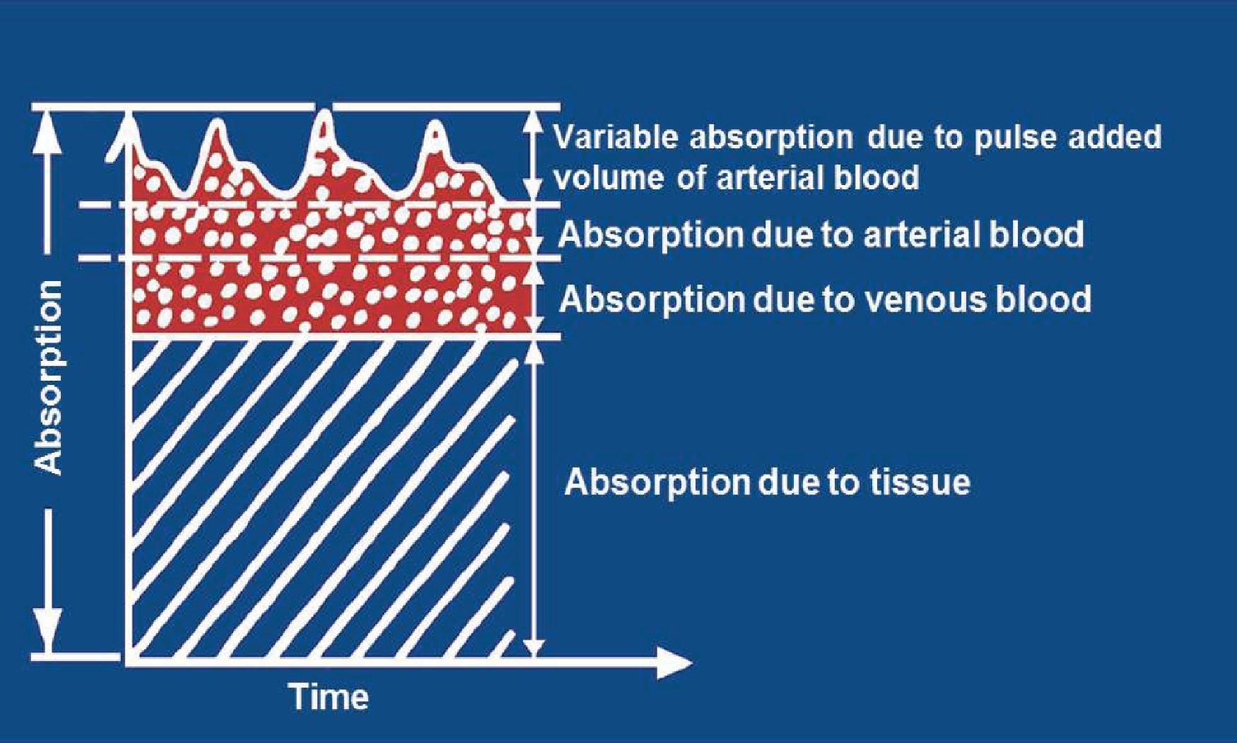 Fig. 20.3, Tissue Absorbances. As light is transmitted through tissues and detected by the photodiode, it is absorbed by all the tissues between the light source and the detector (i.e., skin, muscle, bone, and blood). Because the pulse oximeter is designed to determine a signal only related to arterial blood, it analyzes only the pulsatile absorbance noted at the top of the figure. The pulse oximeter therefore makes the assumption that whatever is pulsing must be arterial blood. In most cases this is true, but in some situations (e.g., patient motion) there can be large venous pulsations which can produce erroneously low saturation values.