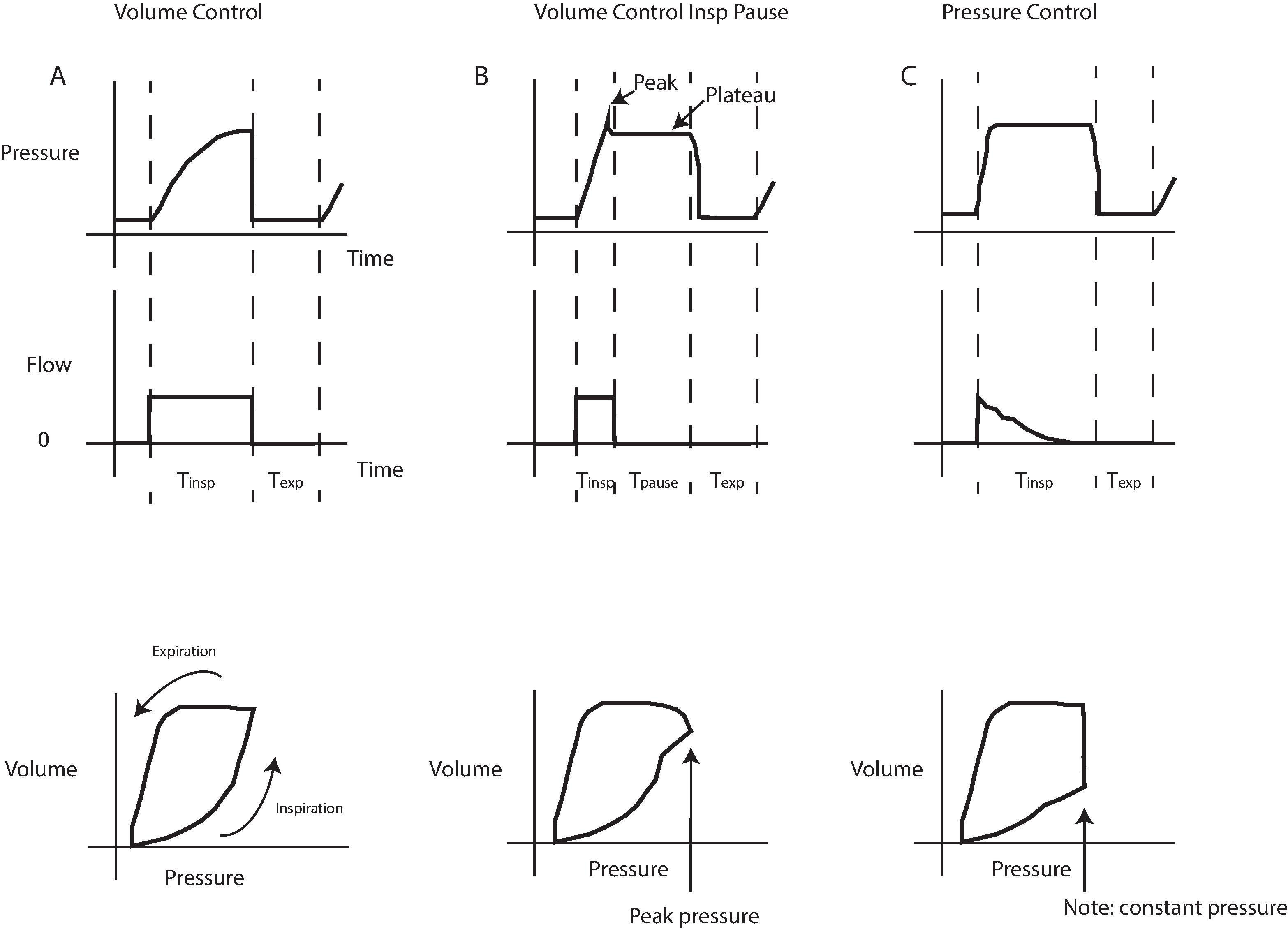 Fig. 20.6, Ventilator Pressure Time Curves. Three commonly employed modes of ventilation generate characteristic curves. (A) Volume control. (B) Volume control with inspiratory pause. (C) Pressure control. Only four variables determine mechanical ventilation: (1) inspiratory time (T insp ), (2) inspiratory pause time (T insppause ), (3) expiratory time (T exp ,), and (4) inspiratory flow rate. In ventilators that have control loops faulty monitoring can lead to inadequate or hazardous ventilation. The compliance of the lung can be measured by dividing the tidal volume by the pressure. Dynamic compliance reflects the compliance during airflow, so it includes the resistance of the endotracheal tube and the compliance of the lungs. In volume control ventilation (A) the pressure and volume smoothly increase until expiration (which is passive). With an inspiratory pause (B), both the dynamic compliance and the static compliance of the lungs and chest wall can be measured by using either the peak pressure or the plateau pressure, respectively. In pressure control ventilation (C) the pressure is constant as volume increases, until expiration. The pressure–volume loops are different for the various ventilation modes as well.