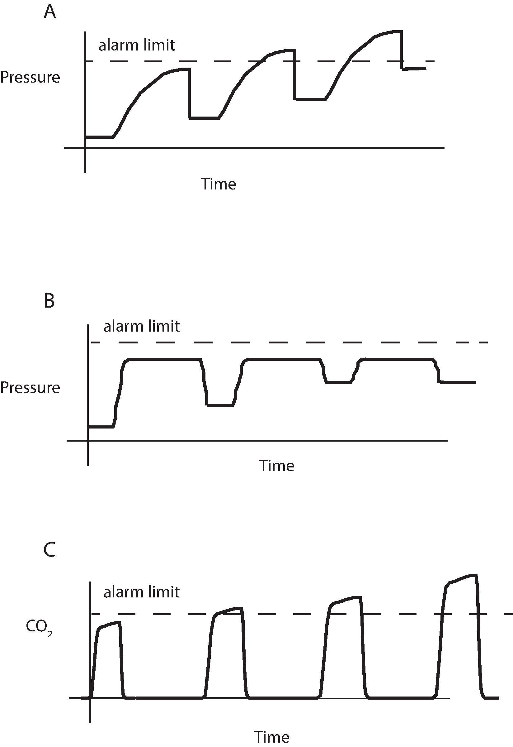 Fig. 20.7, Stacking Breaths. In both volume control (A) and pressure control (B) ventilation insufficient expiratory time leads to “stacking” of breaths and changes in the pressure waveform. In the case of volume control ventilation the pressure can increase, triggering an alarm. With pressure control ventilation, tidal volumes decrease and pressure remains constant. (This may trigger a high PEEP alarm.) The capnogram demonstrates decreased ventilation (increasing CO 2 ) and may change shape as well (C).