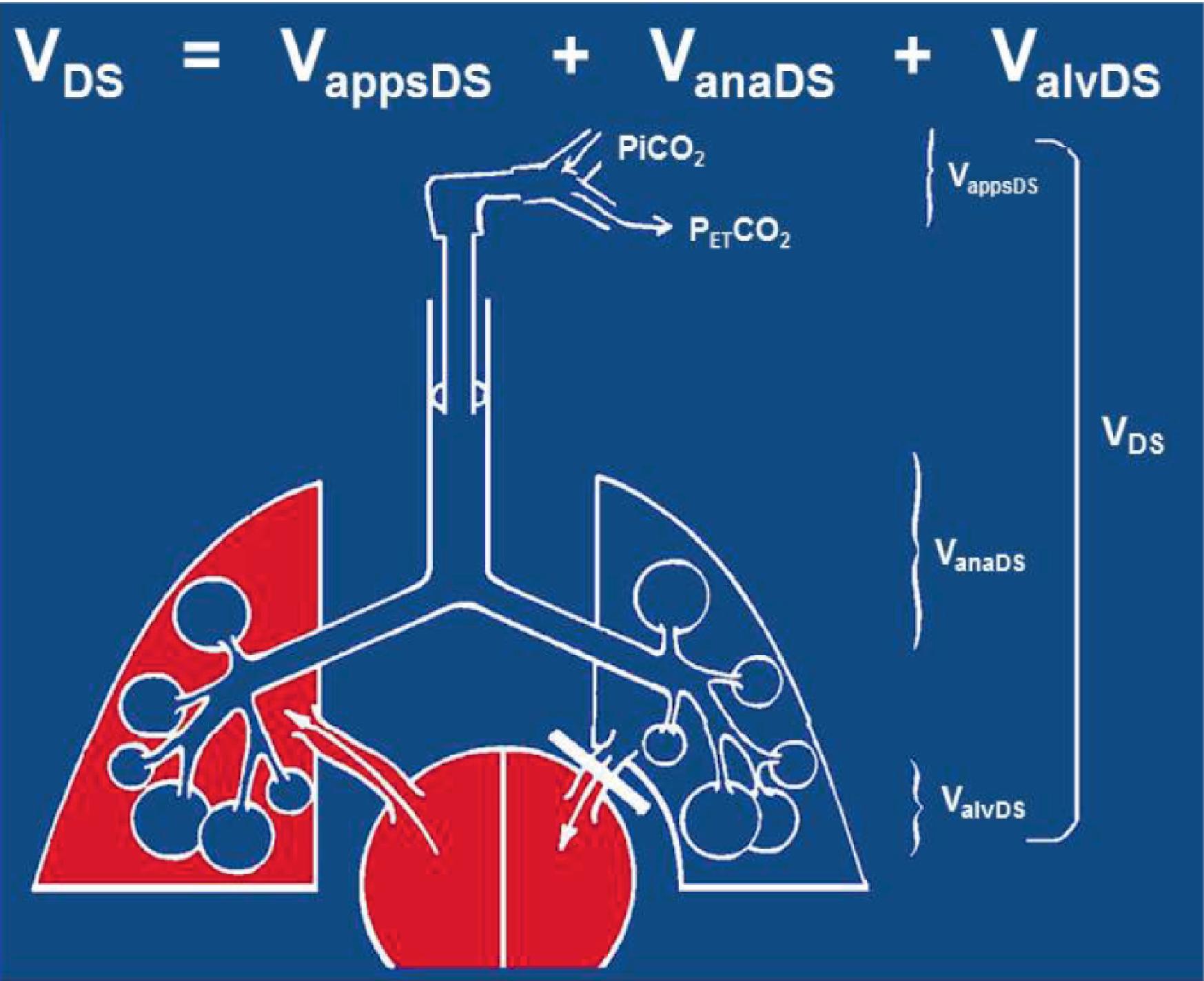 Fig. 20.9, Apparatus, Anatomic, and Alveolar Dead Space. To interpret the capnogram, one must first understand dead space and its components. This schematic shows the heart, lung, and ventilator circuit up to the Y-connector. Dead space volume (V DS ) is defined as any portion of the tidal volume that does not participate in gas exchange. It is further divided into three components: apparatus dead space (V appsDS ), anatomic dead space (V anaDS ), and alveolar dead space (V alvDS ). The apparatus dead space is the volume of gas between the Y-connector and the end of the endotracheal tube. The anatomic dead space is the dead space of the trachea and all conducting airways down to the alveoli. The alveolar dead space includes all nonperfused alveoli. In the figure the lung on the right has no blood flow, so all those alveoli are not perfused and therefore at the end of inspiration will have zero carbon dioxide. The lung on the left is well-perfused, and those alveoli can be assumed at the end of inspiration to equilibrate to the arterial carbon dioxide (PaCO 2 ) value.