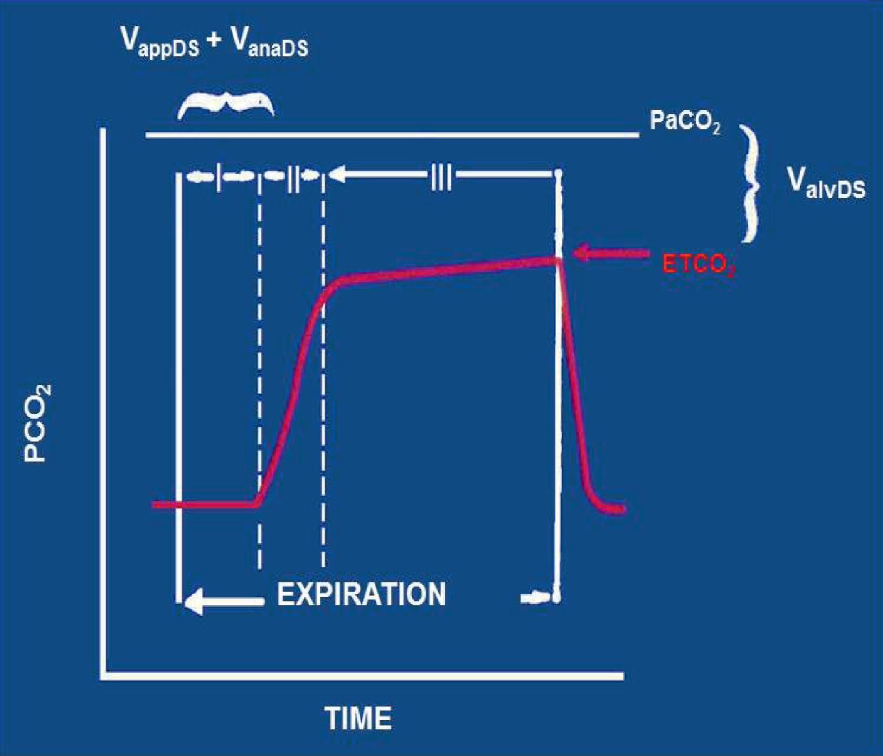 Fig. 20.10, Normal Capnogram. A capnogram is a continuous tracing of the carbon dioxide concentration sampled at the Y-connector on an intubated, ventilated patient and plotted versus time during the inspiratory and expiratory cycle. It can be divided into three phases. The first phase is the beginning of expiration when the apparatus and anatomic dead space are being sampled, both of which have zero carbon dioxide. Phase I starts when the mixed alveolar gases are detected and the capnogram rises up and reaches a plateau value, Phase III, which has only a slight rise as the mixed alveolar gases, are sampled during the end of the expiratory cycle. With the initiation of inspiration, the CO 2 value drops to zero and stays at zero until the next expiration. Note the end peak value is the ETCO 2 .