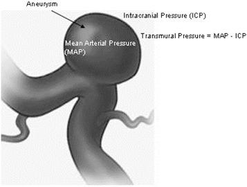 Figure 1, Schematic diagram showing the determinants of the transmural pressure.