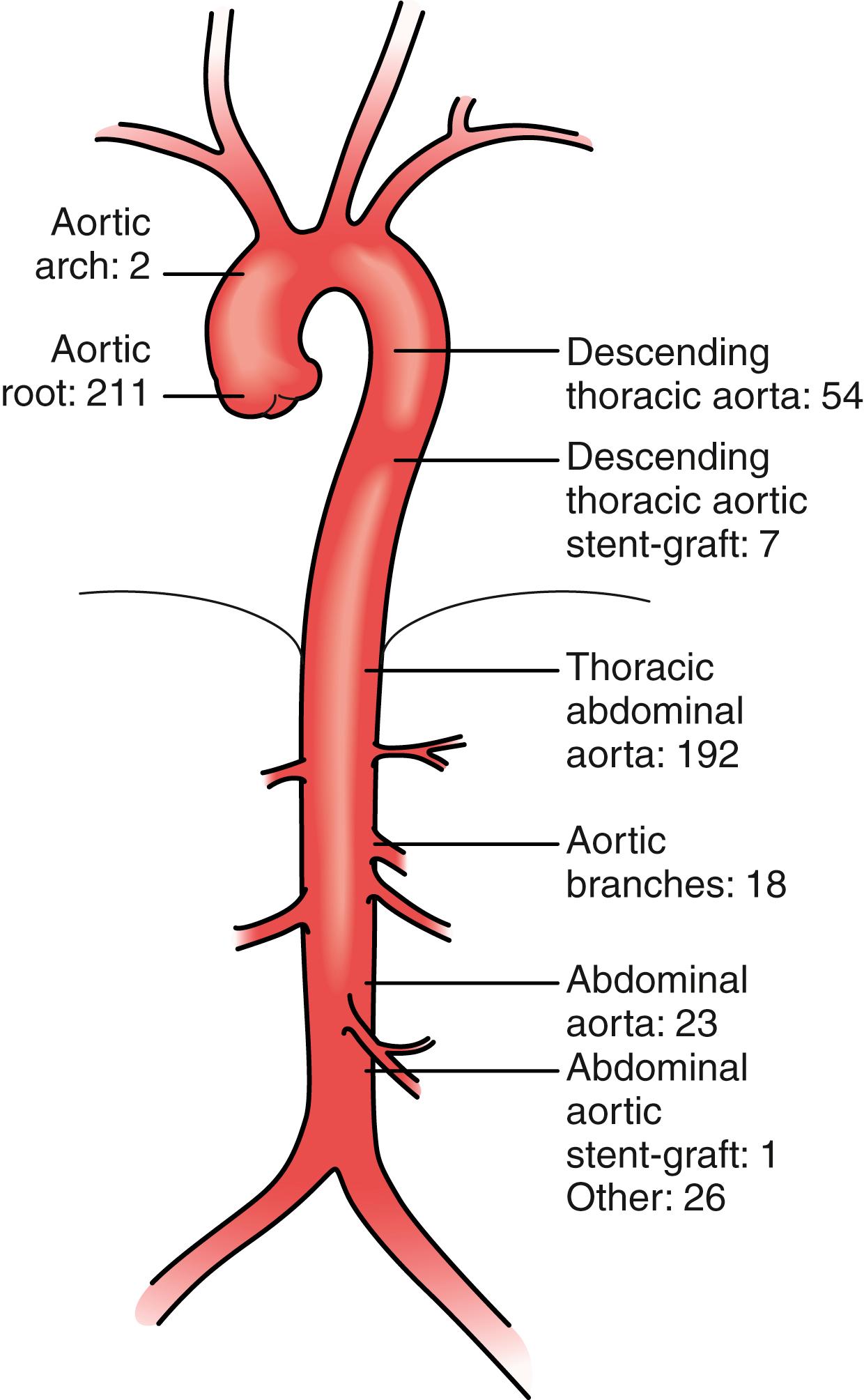 Figure 141.3, Distribution of vascular repairs in 300 patients with Marfan syndrome.