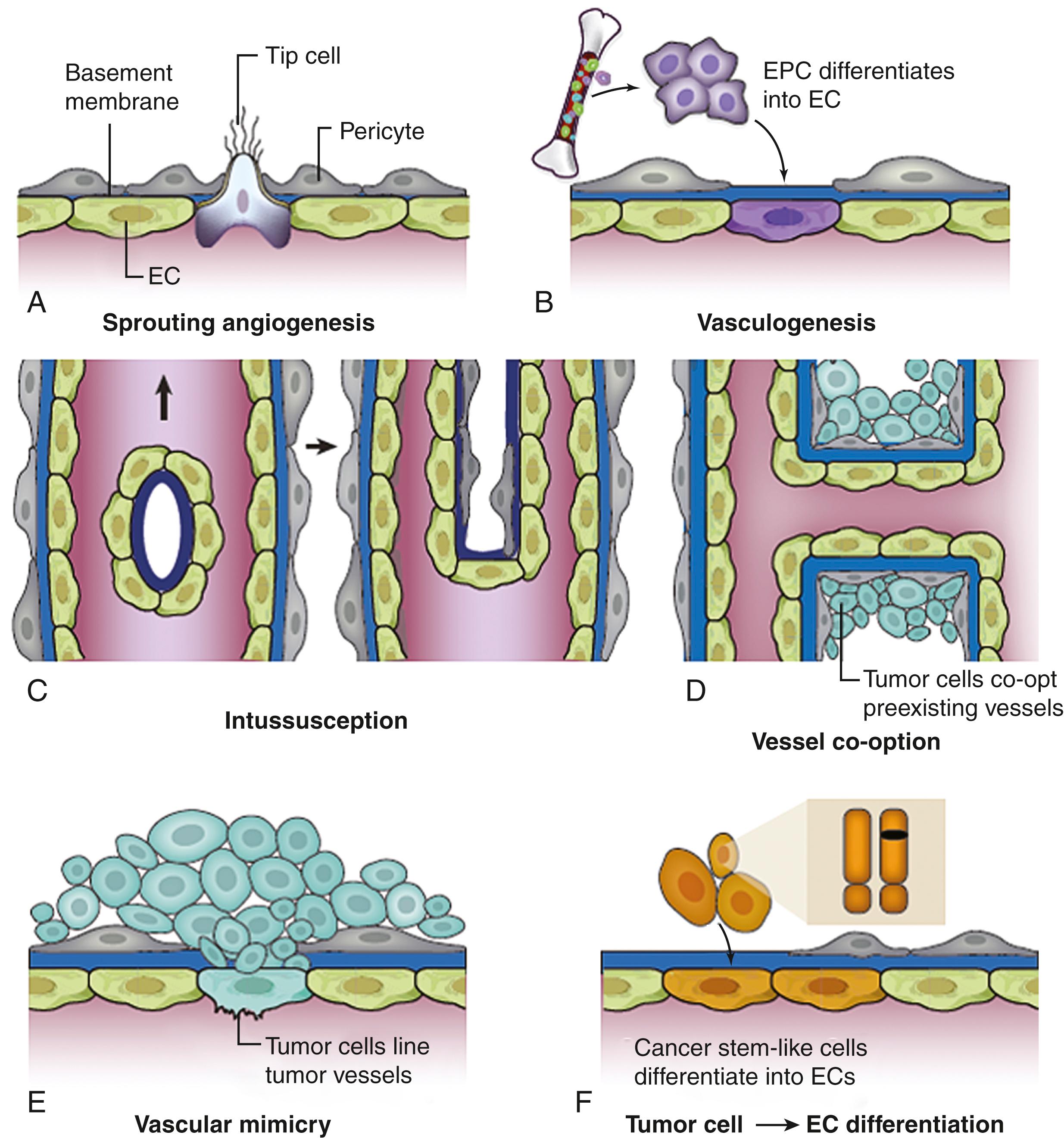 Figure 140.5, Mechanisms of physiologic (normal) angiogenesis and escape in cancer.