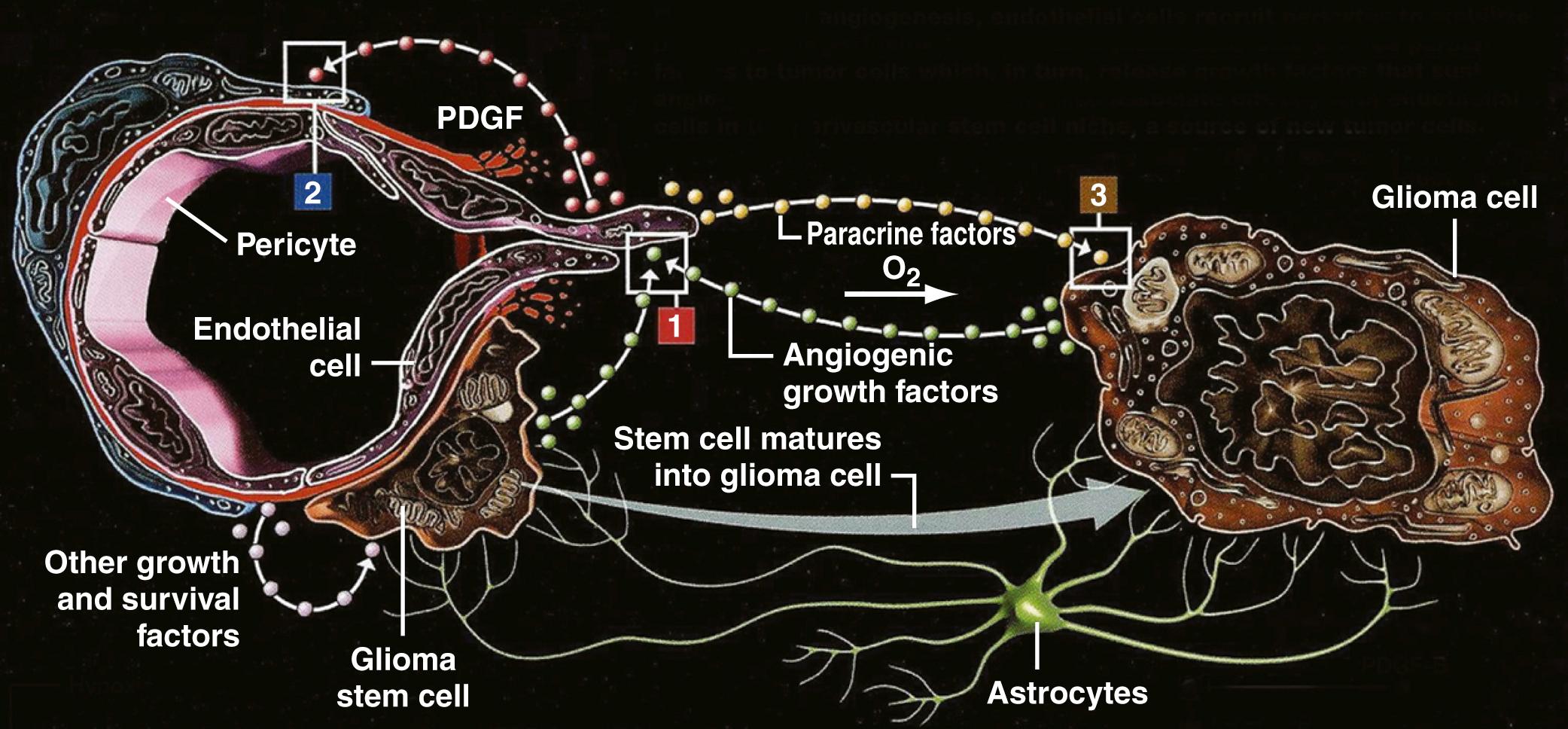 Figure 140.8, The vascular niche and cellular interactions in brain tumor angiogenesis.