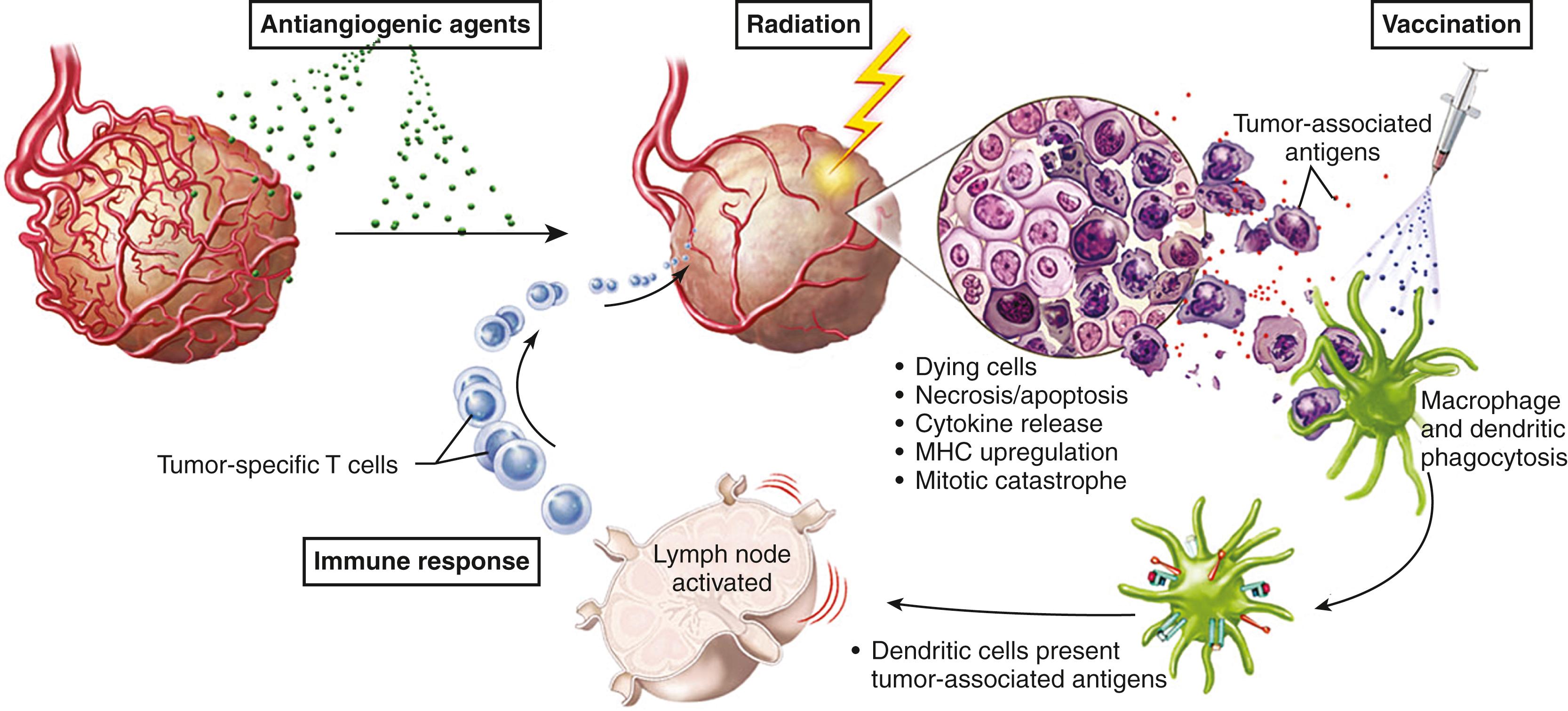 Figure 140.9, The combined use of radiation, immunotherapy, and angiogenesis inhibitors.