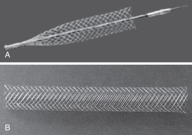 FIG 24.1, (A) Deployment of the Wallstent is achieved by withdrawing the constraining sheath. (B) The fully deployed Wallstent.