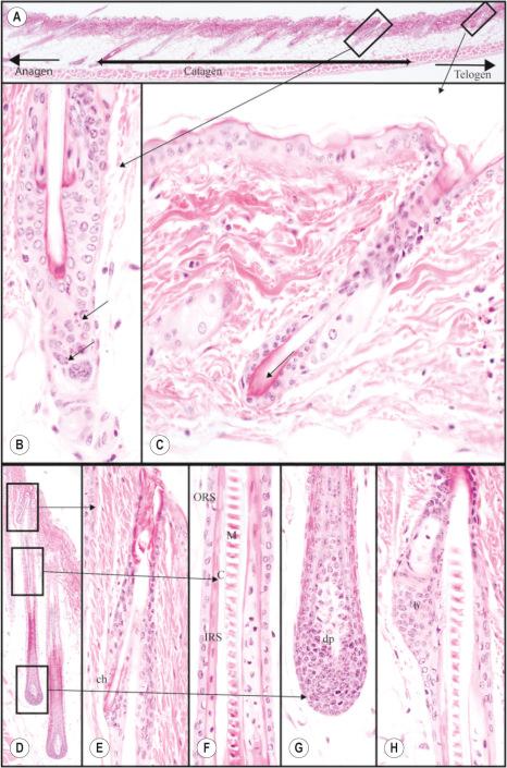 Fig. 36.6, B6(Cg)- Tyr c2J /J (albino or a white black mouse) hair cycle in one section ( A ). Anagen ( left ) transitions to catagen ( B , middle ) to telogen ( C , right ). Note the marked apoptosis ( arrows ) below the club hair and redundancy of the contracting basement membrane of the catagen follicle ( B ). Telogen hair has the short residual hair club ( arrow , C ). Late anagen stage hair follicles ( D ). Old club hair (ch) is not pushed out by the new hair shaft but rather is pushed to the side ( E ). ( F ) Mid-level of the follicle illustrates the hair medulla (M), hair shaft cuticle (C), inner root sheath (IRS), and outer root sheath (ORS, C). Hair bulb and dermal papilla (dp, G ). Another anagen stage follicle at a different angle illustrates the sebaceous gland and underlying bulge (b, H ) which contains the hair follicle stem cells.