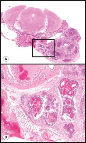 Fig. 36.7, This is a 91-day-old female mouse with botryomycosis. ( A ) Note the pink immune complexes (Splendore-Hoeppli phenomenon) surrounded by neutrophils and a wall of macrophages and fibroblasts. ( B ) Lower panel is enlargement of boxed area.
