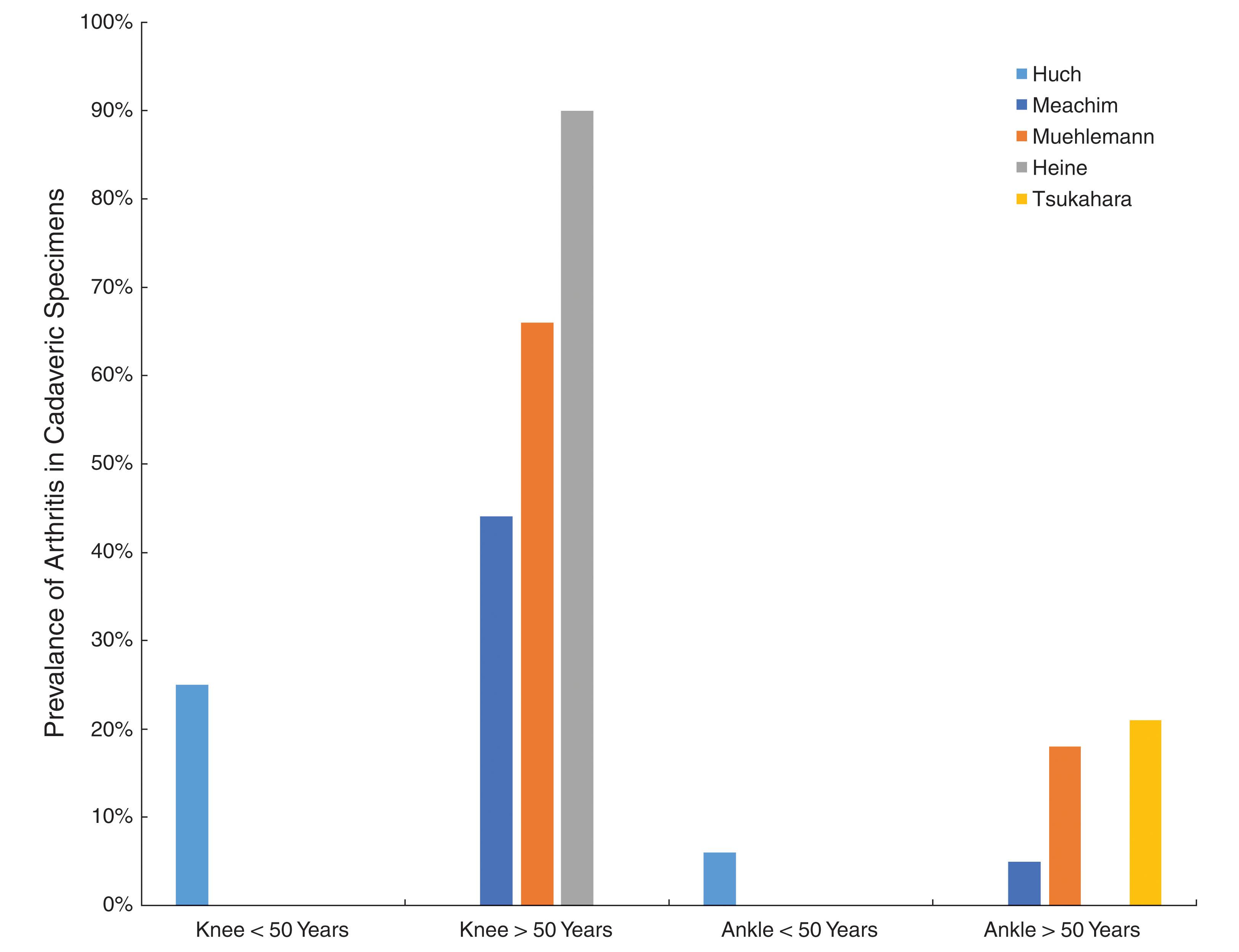 Fig. 22-1, Histogram showing the prevalence of ankle joint degeneration in autopsy studies reported by Huch et al, 7 Meachim, 3 6 Muehleman, 11 Heine, 12 and Tsukahara. 13 In these studies, the criteria for joint degeneration (osteoarthritis) were extensive articular cartilage fibrillation, osteophytes, and regions of full-thickness cartilage loss (Collins grades 3 and 4). 9 Notice that joint degeneration was more than three times as common in the knee as in the ankle and that the prevalence of joint degeneration in the knee and the ankle increased with age, though more so in the knee.