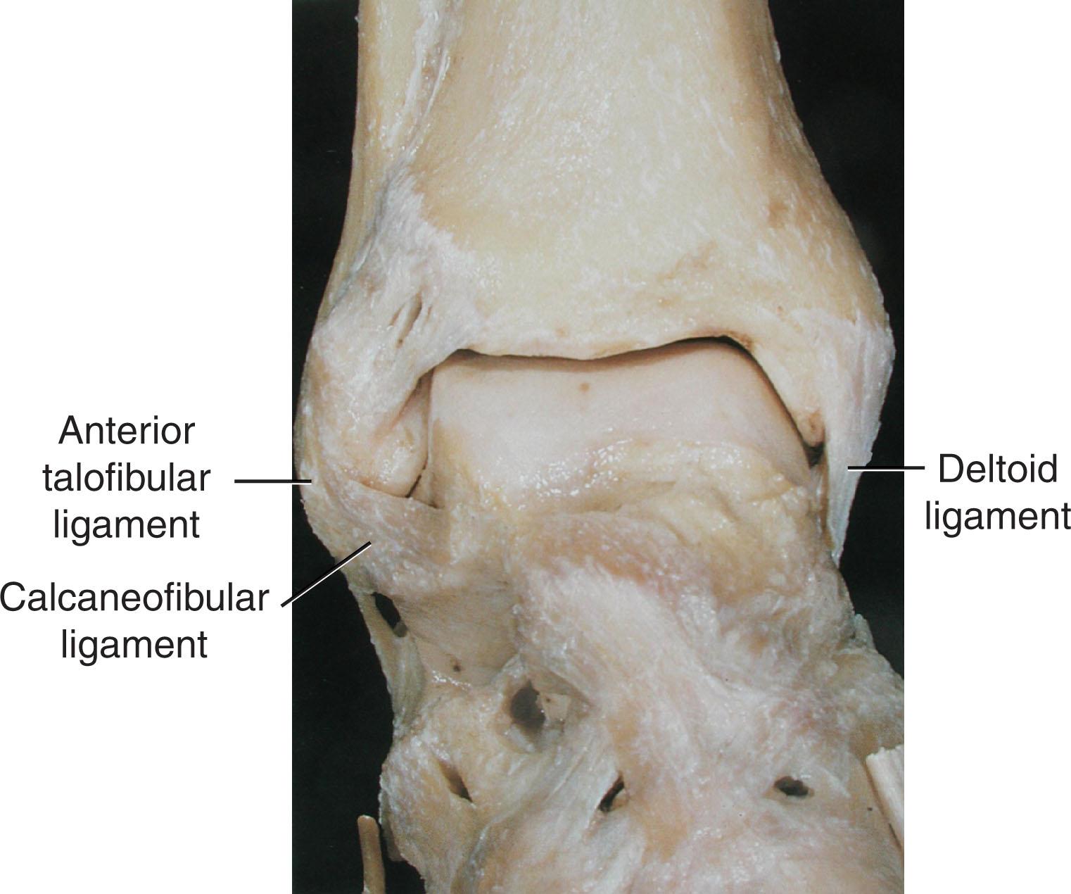 Fig. 44-1, Anterior anatomy of the ankle.