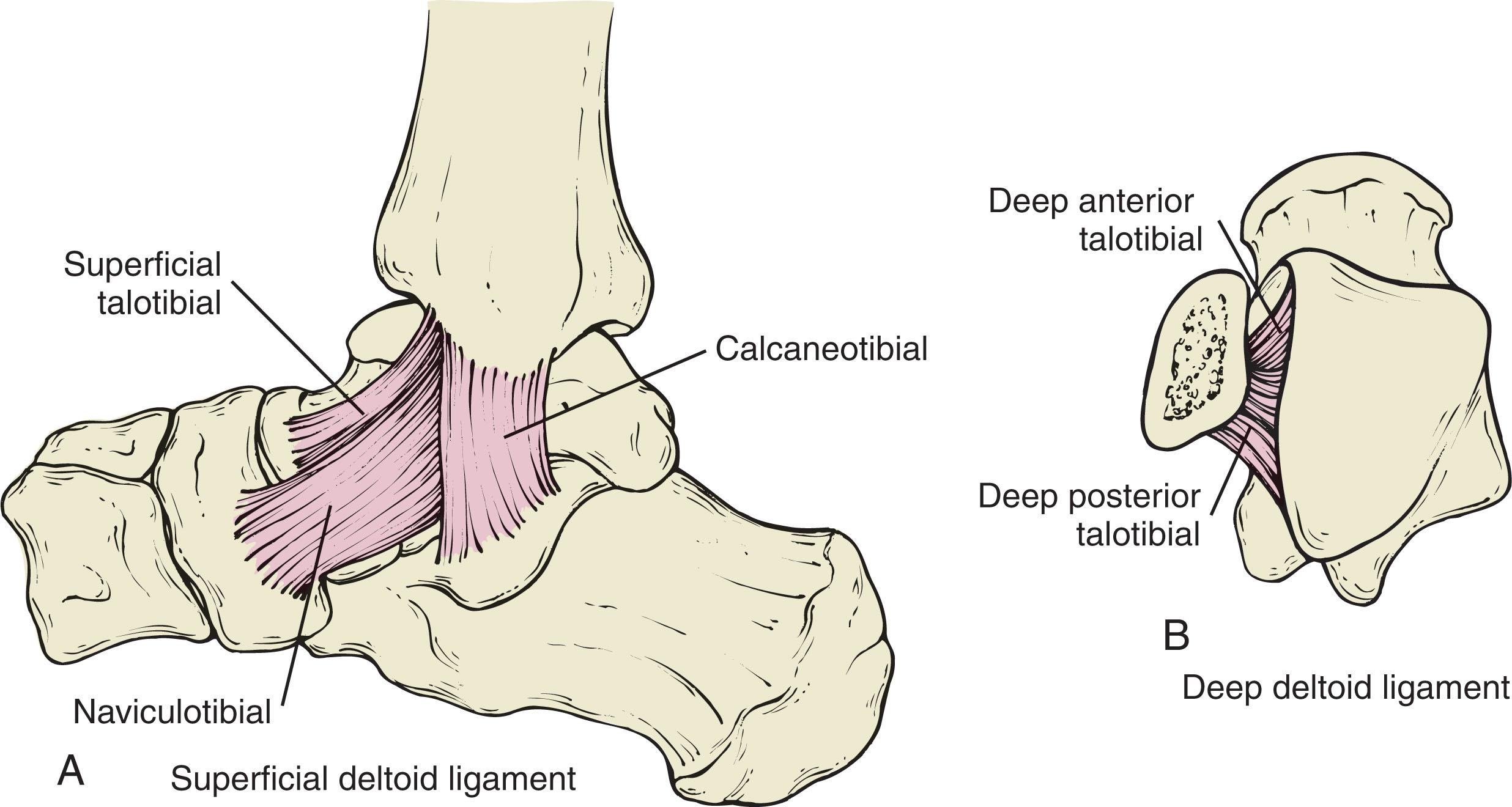 Fig. 44-2, Medial anatomy of the ankle. A , Superficial components of the deltoid ligament. B , Deep components of the deltoid ligament.