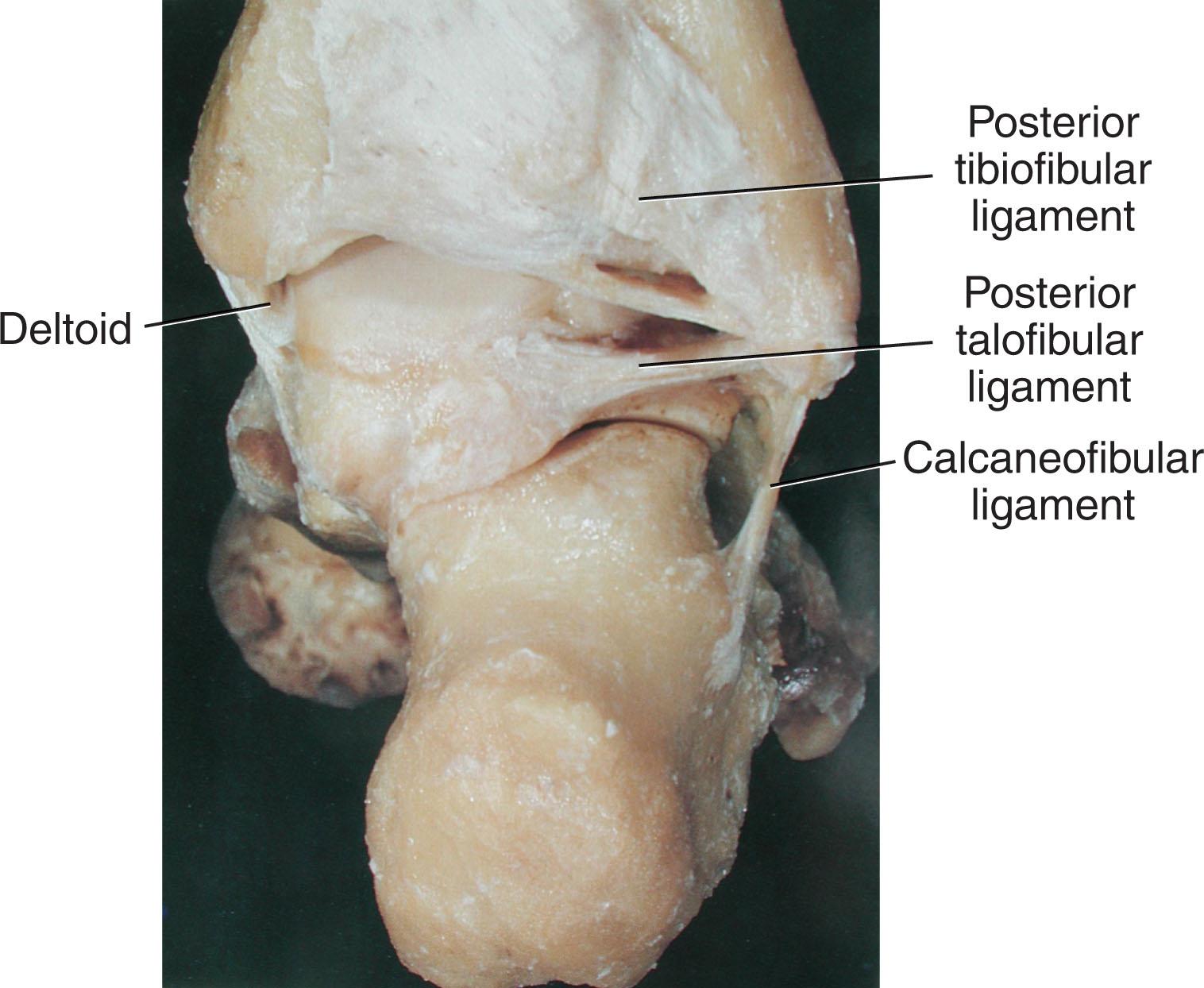 Fig. 44-4, Posterior anatomy of the ankle.