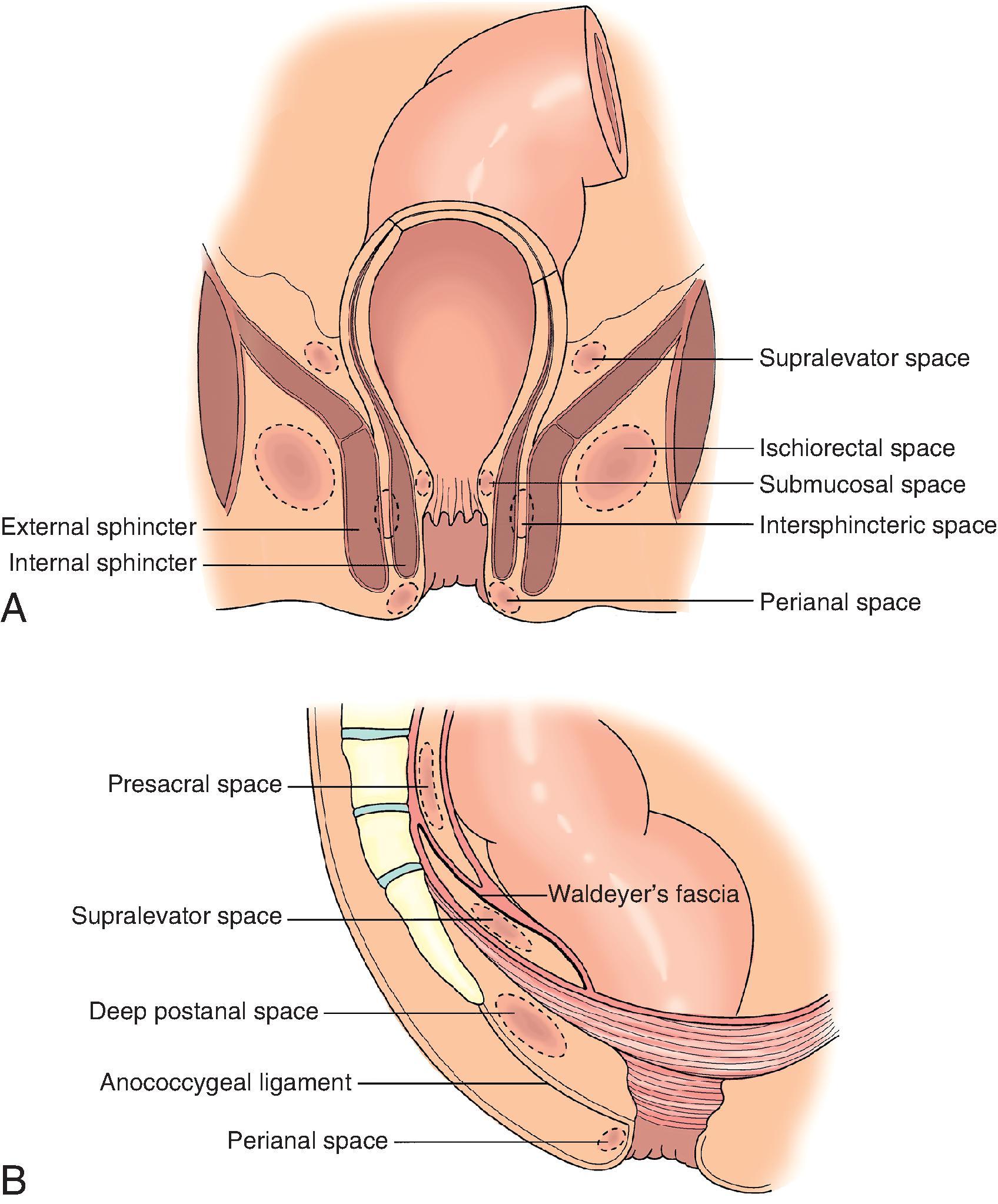 FIG. 1, Anal sepsis and fistula. Classification of anorectal abscesses by location. (A) Coronal view. (B) Sagittal view.