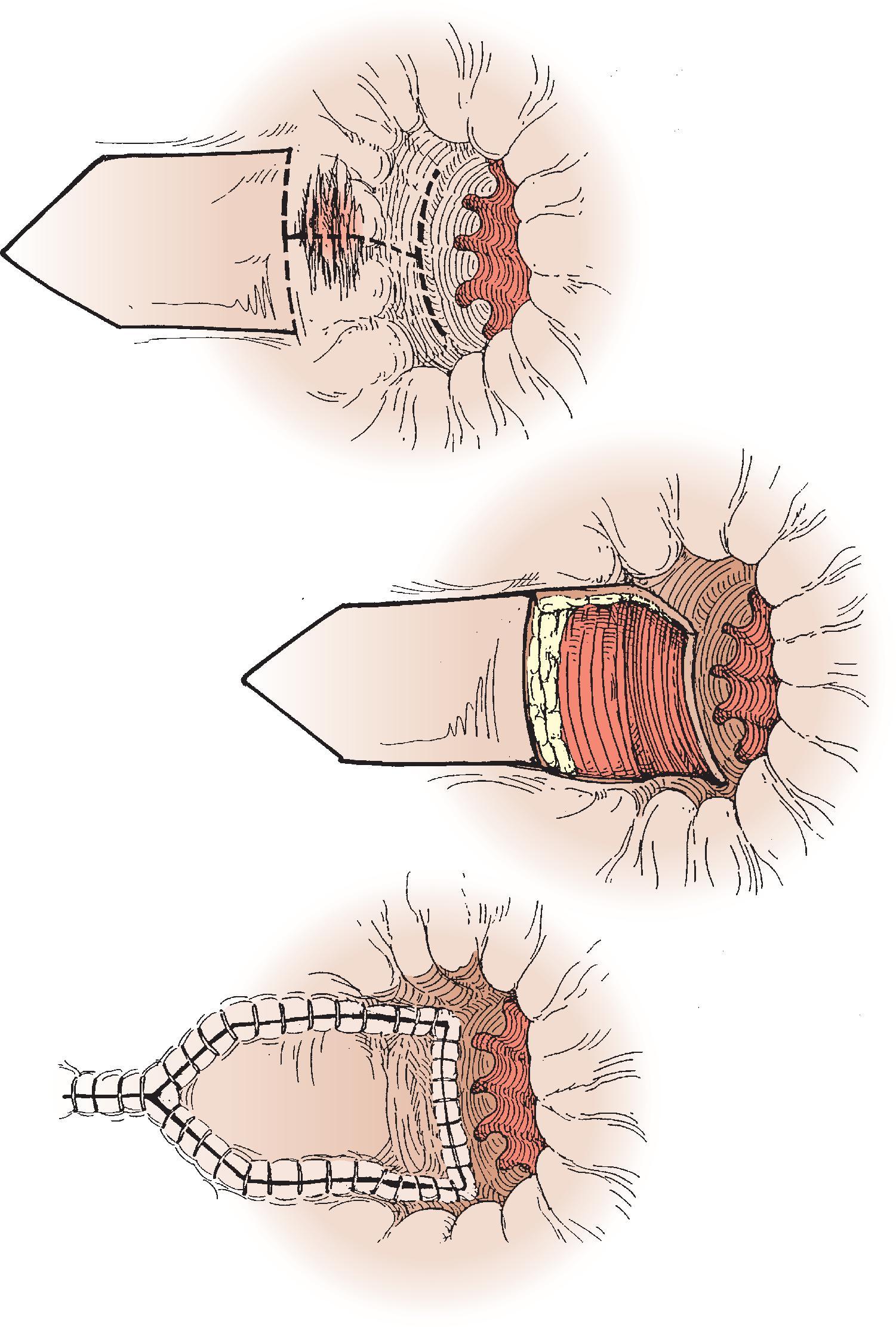 FIG. 4, House flap.