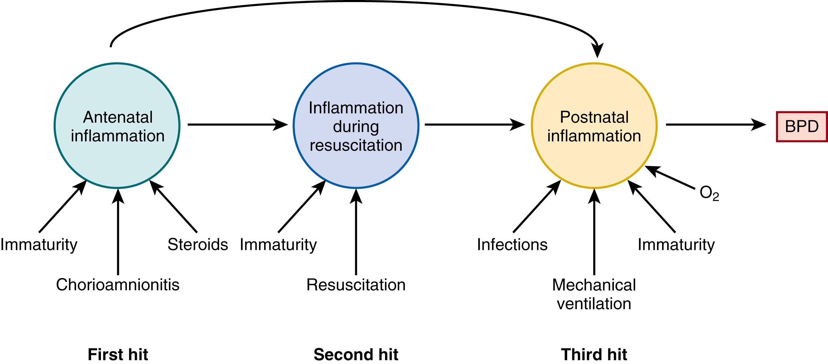 Fig. 71.1, A model for the interplay of fetal exposures on early postnatal events that may contribute to altered lung development and injury. BPD, Bronchopulmonary dysplasia.