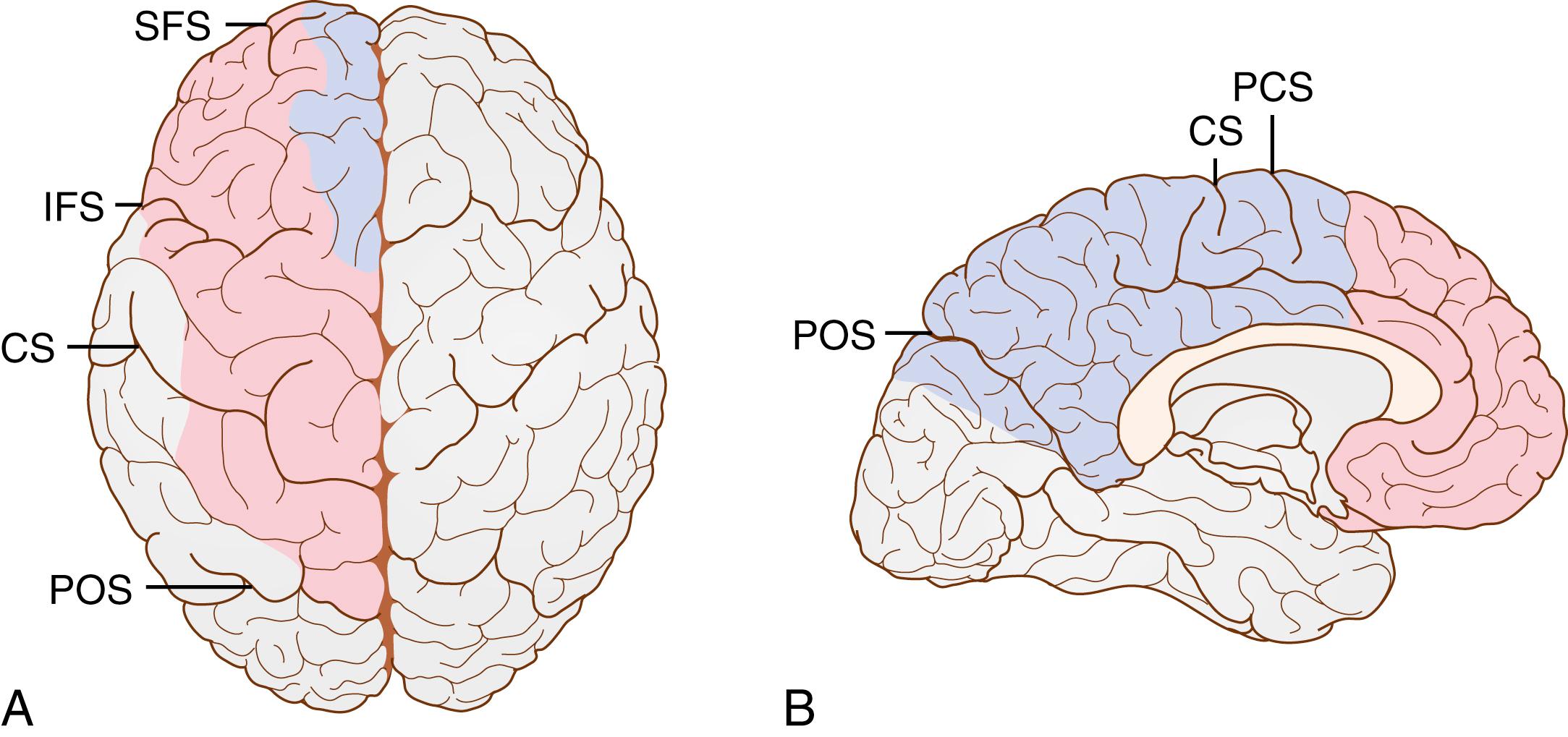 Fig. 23.2, Cortical distribution of the anterior cerebral artery. (A) Area of variation on the cerebral convexity. (B) Area of variation on the cerebral medial surface. Combined pink and gray areas represent a composite of maximal extent. Gray areas represent a composite of minimal extent. CS , Central sulcus; IFS , inferior frontal sulcus; PCS , precentral sulcus; POS , parieto-occipital sulcus; SFS , superior frontal sulcus.