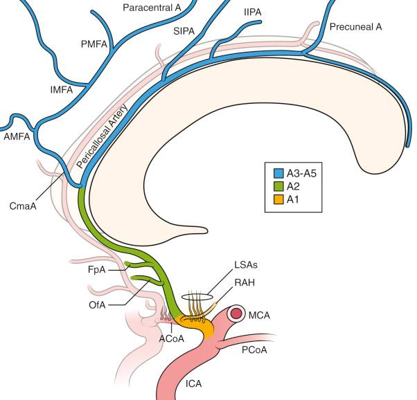 Figure 17.2, The anterior cerebral artery is divided into five segments, A1 through A5. A1 includes the anteromedial central (medial lenticulostriate), the recurrent artery of Heubner (variable), and the anterior communicating artery. A2 branches include the orbitofrontal artery (medial frontal basal) and the frontopolar artery. A3, also termed the pericallosal artery, gives rise to the callosal marginal artery and then terminates as the internal parietal arteries (superior, inferior) and the precuneal artery. The callosal marginal artery in turn branches into the medial frontal arteries (anterior, intermediate, posterior) and the paracentral artery. A4 and A5 segments are the distal smaller branches, often named the callosal (supracallosal) arteries.