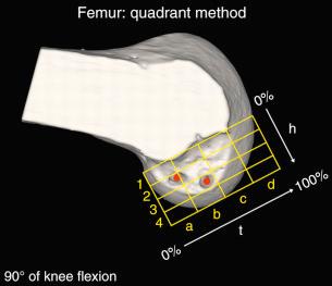 FIG 7-15, On the femoral side, the locations of the anteromedial and posterolateral tunnel aperture centers were established within a 4 × 4 grid, which was oriented along the most anterior edge of the notch roof. h, Line perpendicular to the Blumensaat line; t, line parallel to the Blumensaat line.