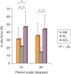 FIG 7-21, In situ force in the intact anterior cruciate ligament (ACL) and its anteromedial (AM) and posterolateral (PL) bundles in response to combined rotatory load (10 N-m valgus and 5 N-m internal tibial torque).