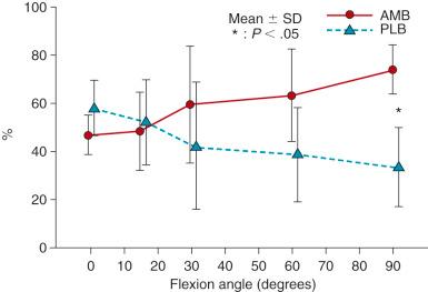 FIG 7-23, Graph showing force sharing between the normal anterior cruciate ligament bundles under 100 N of anterior load. AMB, Anteromedial bundle; PLB, posterolateral bundle.