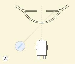 Fig. 1.9, (A) Direct optic section illumination technique. (B) Direct optic section view of the cornea.
