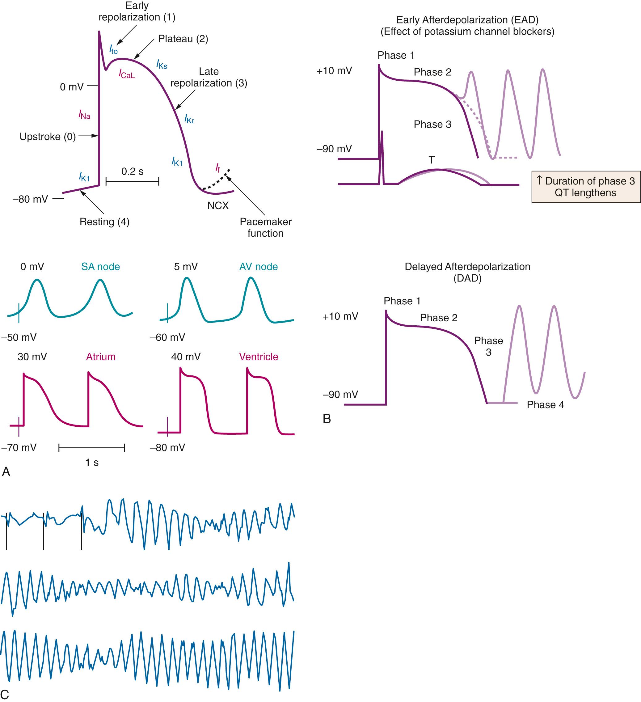 Fig. 27.1, Cardiac action potentials and the electrocardiogram. A, Upper, a generic cardiac action potential illustrating the phases and major currents involved. NCX, sodium/calcium exchanger. Lower, comparison of nodal ( SA, sinoatrial; AV, atrioventricular), atrial, and ventricular action potentials. B, Upper, ventricular action potential superimposed on an electrocardiogram (ECG) showing the QT interval–prolonging effects of potassium channel block and resultant early afterdepolarizations. Lower, delayed afterdepolarizations. C, ECG showing torsades de pointes.