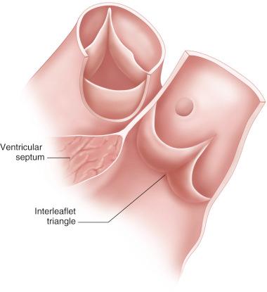 Figure 11.3