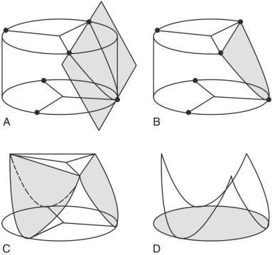 Figure 13.3, The aortic annulu evolves along a cylinder.