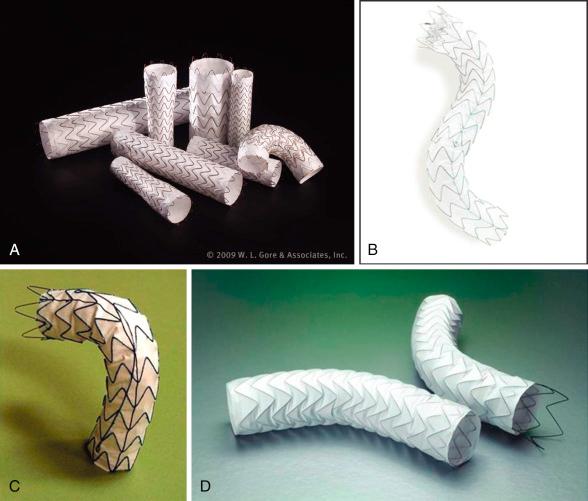 Fig. 44.5, A selection of thoracic stent grafts from American manufacturers that are available in Europe: (A) TAG. (B) Valiant. (C) Relay stent-graft. (D) EndoFit.