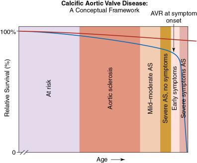 Fig. 9.1, Slow Progression of Aortic Stenosis (AS) .