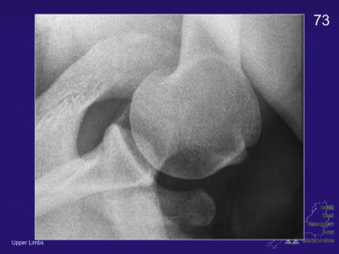 Fig. 45.16, Modified Axial View.