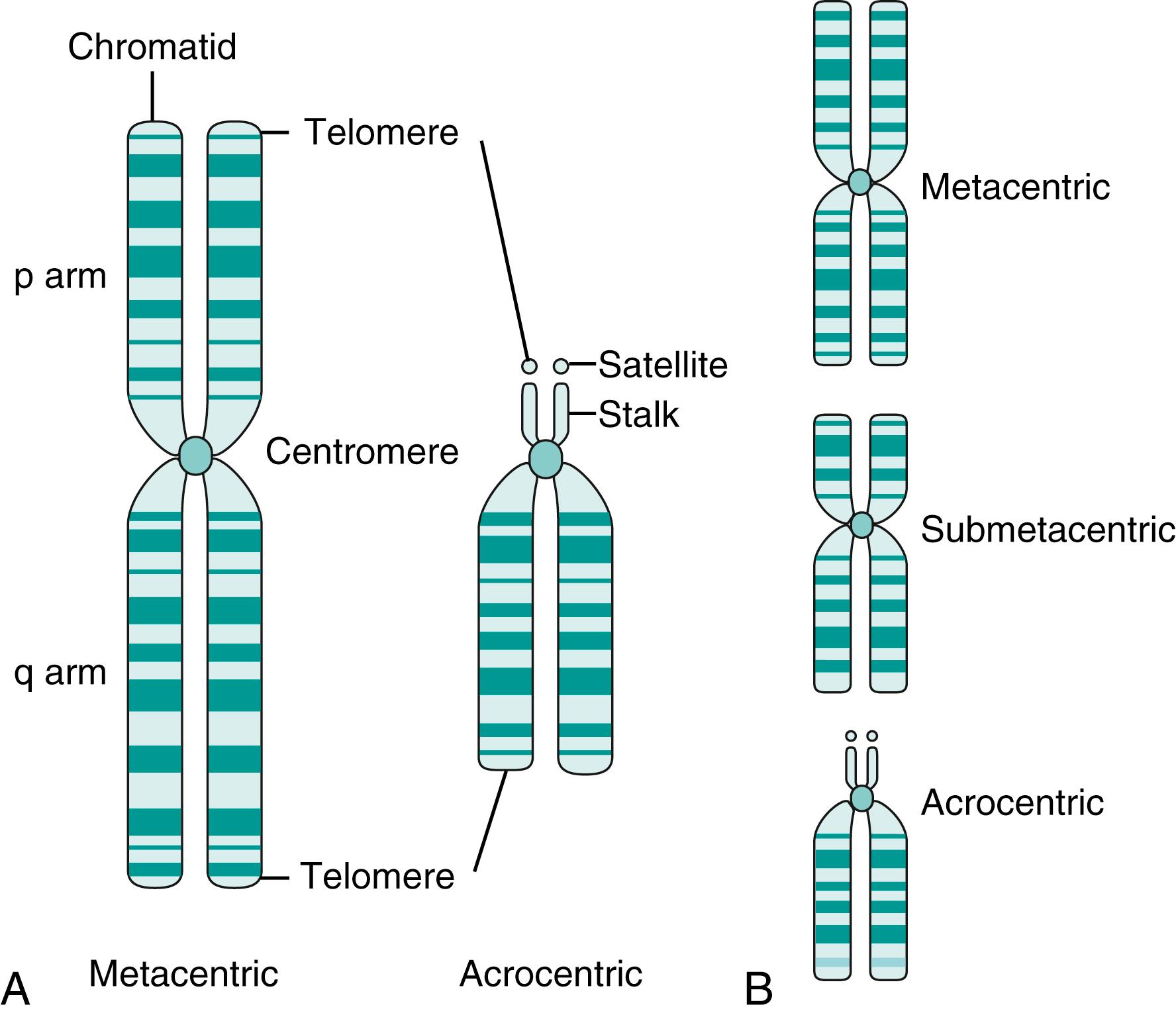 Fig. 71.2, Chromosome structure. A Schematic of metaphase chromosome anatomy showing major landmarks. Each chromosome is composed of two chromatids held together by the centromere. The telomere is the end structure of the chromosome. A typical metacentric form is contrasted with an acrocentric having a modified short arm structure composed of stalks and satellites. In all cases, the shorter, or p, arm is oriented up and the longer, or q, arm is oriented down. B The relative position of the centromere can vary, resulting in metacentric (centromere near the middle), submetacentric (centromere closer to one end), and acrocentric (modified short arm) chromosomes.