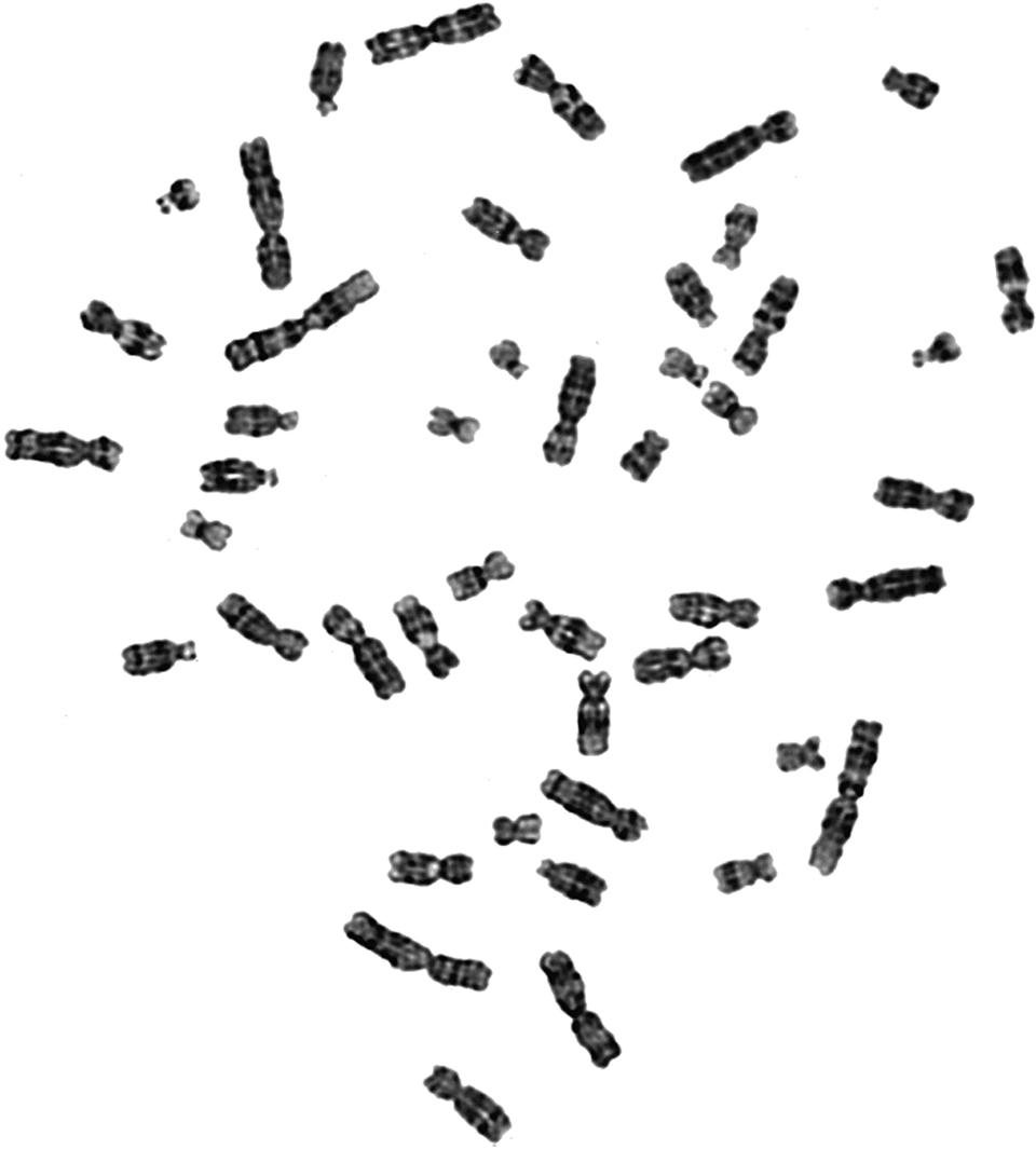 Fig. 71.3, Metaphase chromosome spread. Chromosomes from a single cell as seen on a microscope slide.