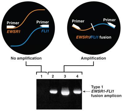 Figure 18.9, Polymerase Chain Reaction (PCR) for Fusion Transcripts.