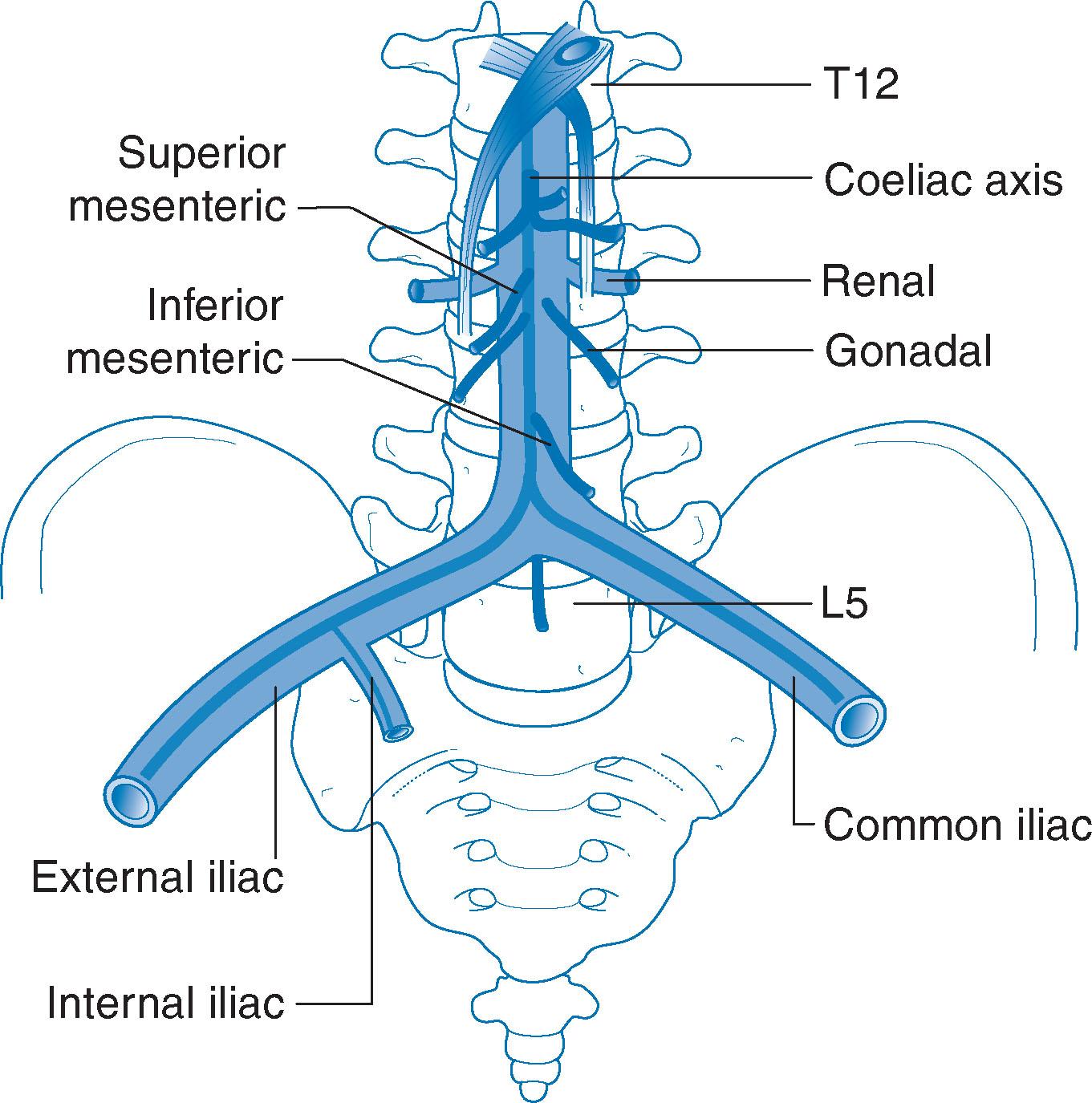 Fig. 5.4, The abdominal aorta and its branches.