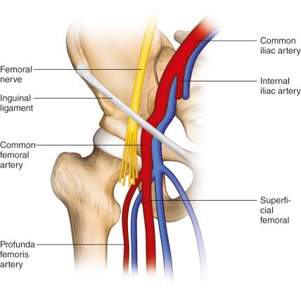 Figure 31.2, Femoral artery anatomy.