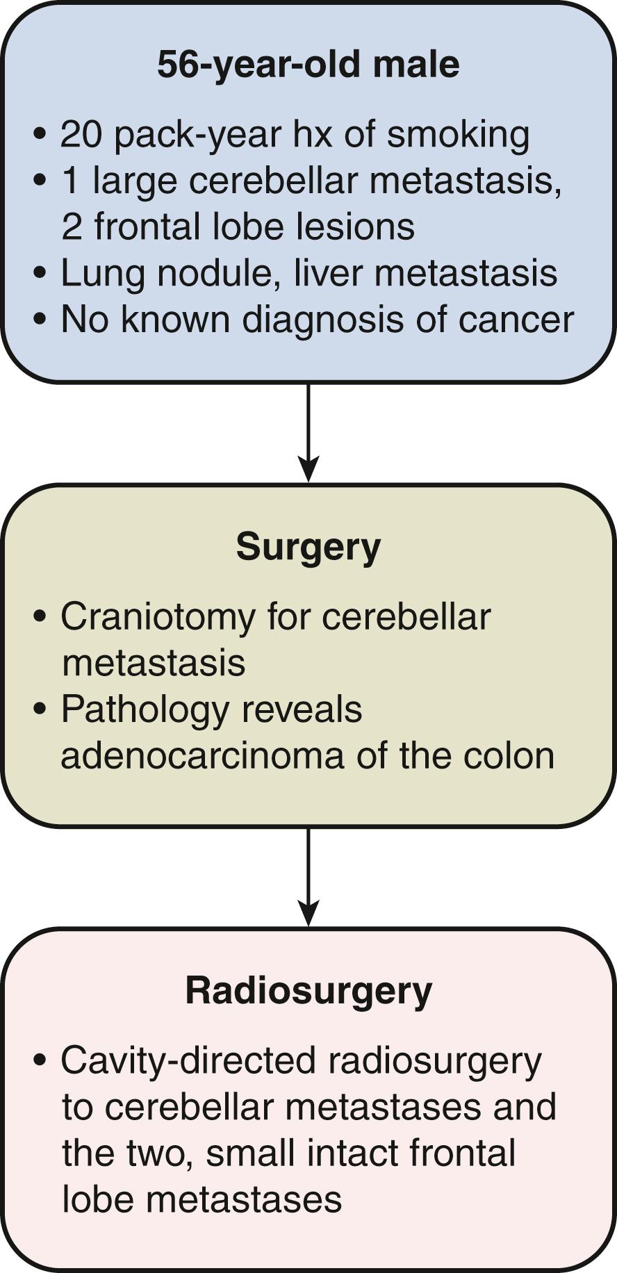 Fig. 14.1, Representative case for craniotomy for management of brain metastases.